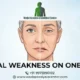 Facial Weakness One Side (